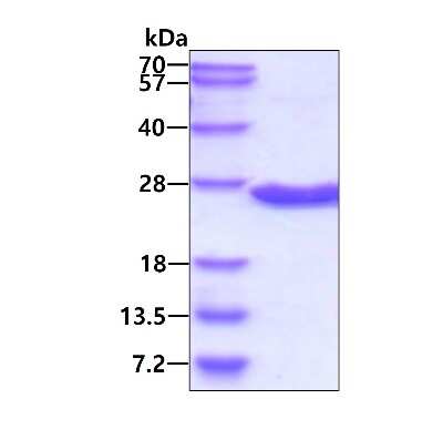 SDS-PAGE: Recombinant Human DUSP13 His Protein [NBP1-98866]